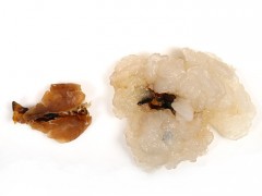 林蛙油林蛙油线油林蛙块油正宗雪蛤线