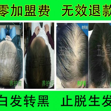 五益草本健康养发护发 无副作用 全国免收加盟费